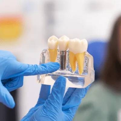 ¿Qué médico trata los problemas dentales estéticos?