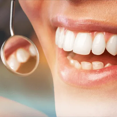 ¿Qué médico trata la sensibilidad dental?